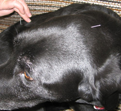 Acupuncture Image 2