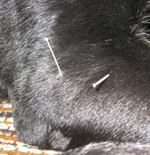 Acupuncture Image 4